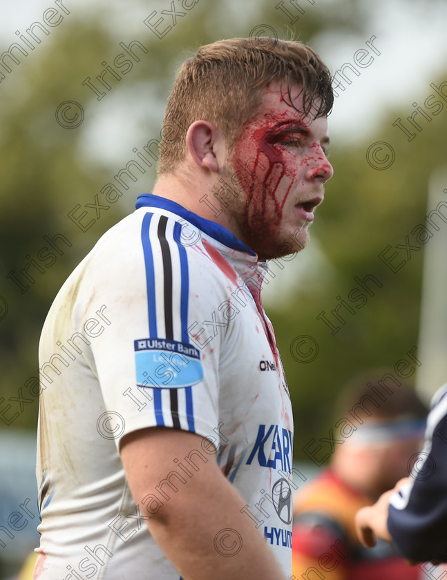 LC-con-10 
 EEXX sport 08/10/2016.
Ulster Bank All-Ireland League; Cork Constitution vs Lansdowne FC at Temple Hill.
Liam O'Connor, Cork Con with a facial injury picked up against Lansdowne FC.
Pic; Larry Cummins