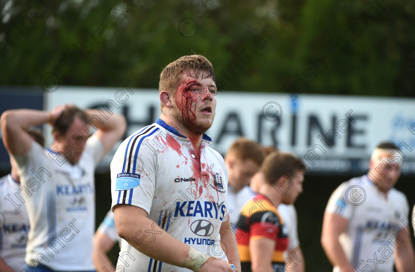 LC-con-11 
 EEXX sport 08/10/2016.
Ulster Bank All-Ireland League; Cork Constitution vs Lansdowne FC at Temple Hill.
Liam O'Connor, Cork Con with a facial injury picked up against Lansdowne FC.
Pic; Larry Cummins